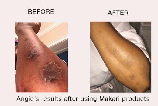 I prodotti Makari sono solo per sbiancare la pelle?